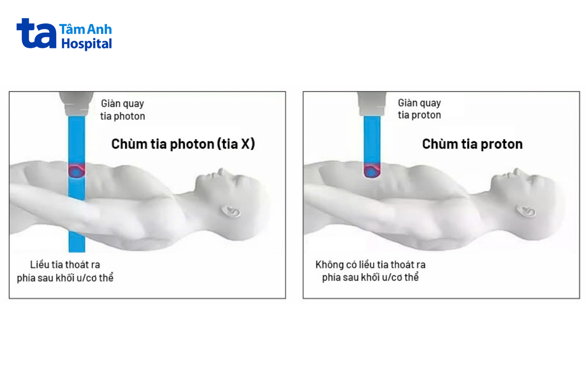 So sánh chùm tia photon và chùm tia proton